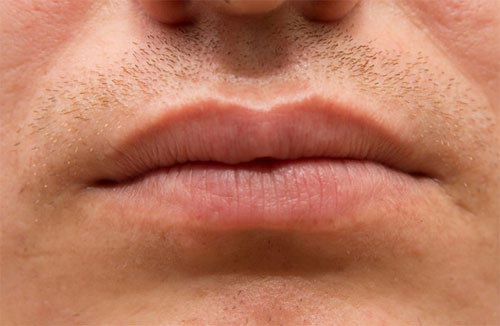 Männer schmale lippen Mundausdrücke und
